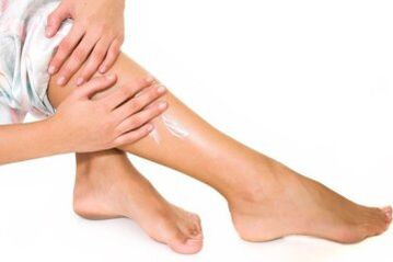 Traitement des varices